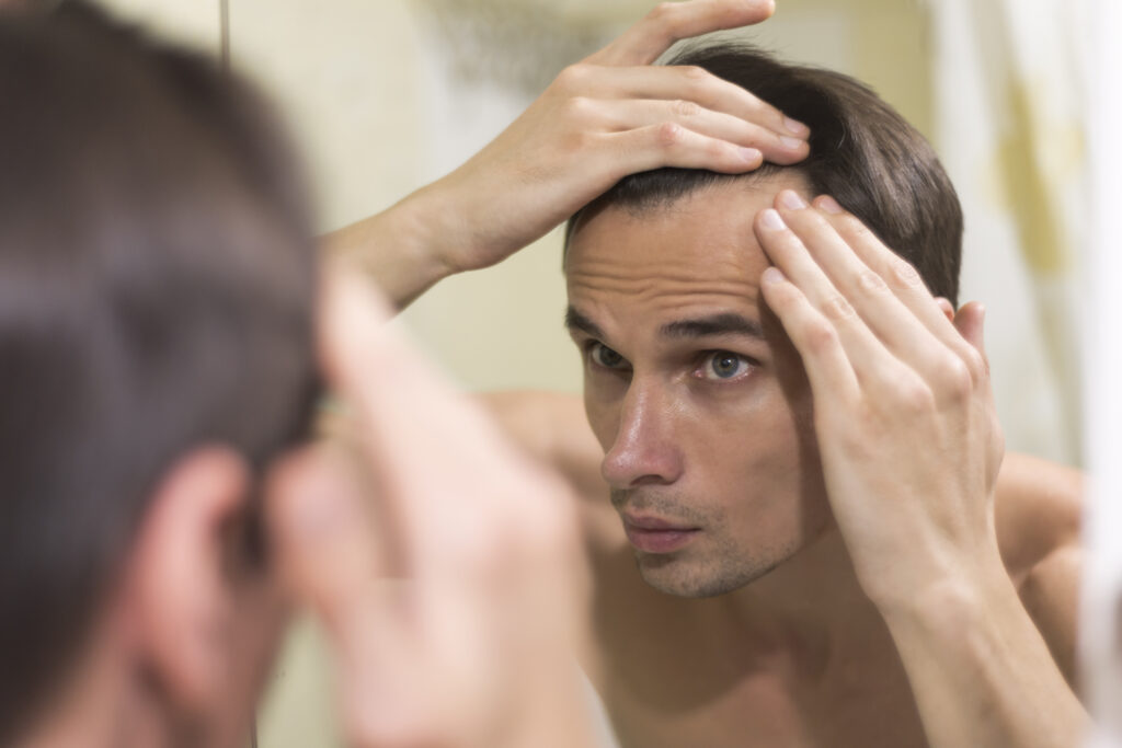 Hair Loss in Men